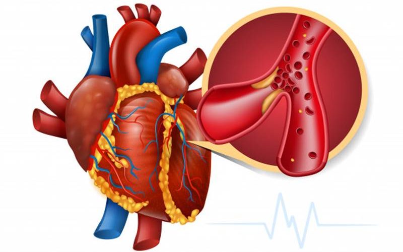 knjige o kardiologije hipertenziju nestabilnost u hodu u hipertenzije
